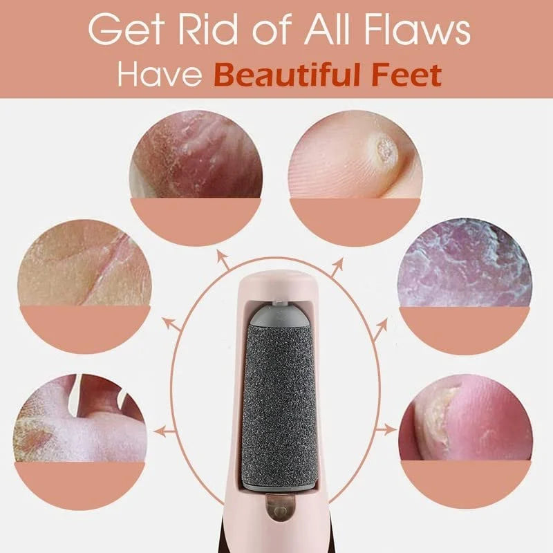 Electric Leg Skin Remover