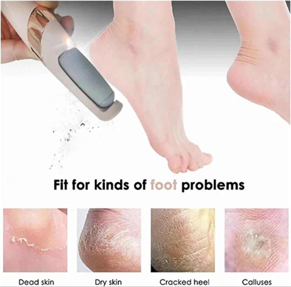 Electric Leg Skin Remover